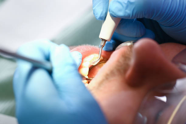 Best Emergency Treatment for Toothache in Ridgebury, CT