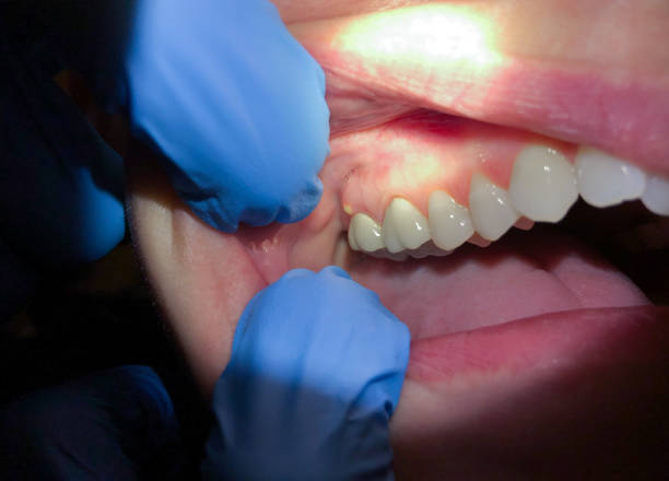 Best Emergency Orthodontic Repairs in Ridgebury, CT